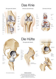 Das Knie / Die Hüfte